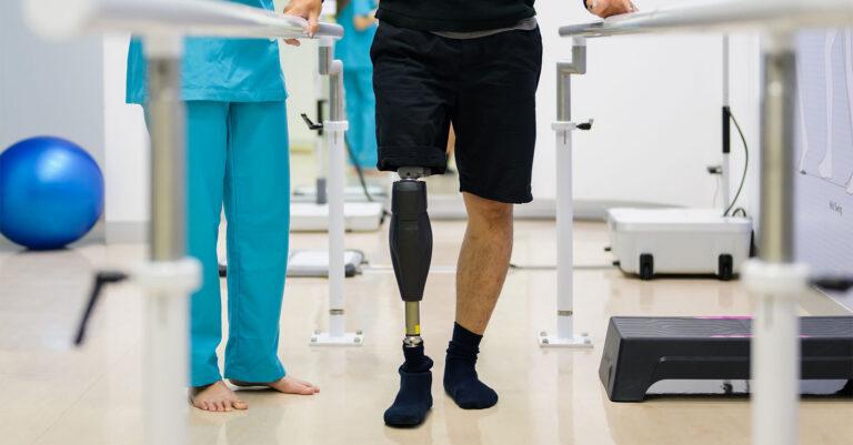 Amputation Negligence Claims in South Africa